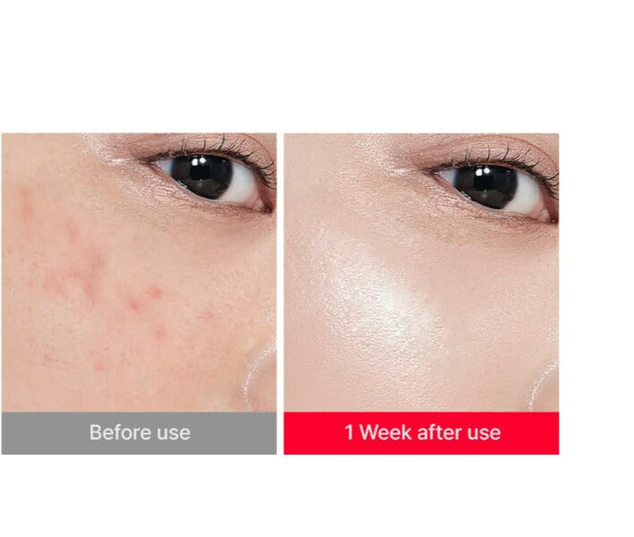 KOEC Cross-border Centella Asiatica HA Elastic Moisturizing Facial Cream,