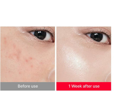 KOEC Cross-border Centella Asiatica HA Elastic Moisturizing Facial Cream,