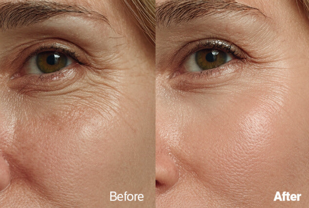 Trendora™  Deep Collagen Peptide