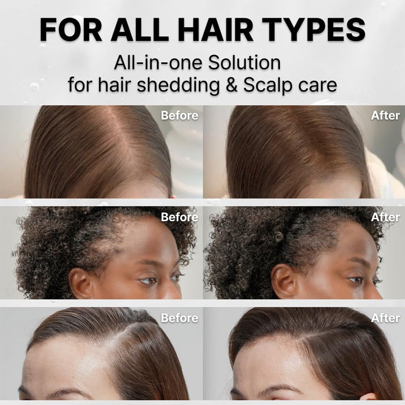 Hair Growth Serum