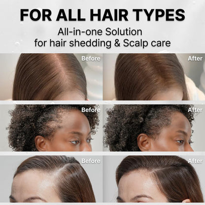 Hair Growth Serum