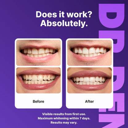 Purple Whitening Tooth Patch